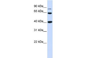 WB Suggested Anti-CTNNB1 Antibody Titration: 0. (CTNNB1 Antikörper  (C-Term))
