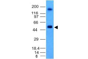 Image no. 2 for anti-Carbonic Anhydrase IX (CA9) antibody (ABIN6182201) (CA9 Antikörper)
