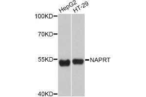Western blot analysis of extracts of various cell lines, using NAPRT Antibody (ABIN4904492) at 1:3000 dilution.