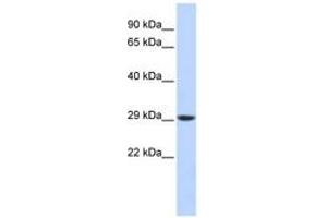 Image no. 1 for anti-Proteasome Subunit Alpha Type 3 (PSMA3) (C-Term) antibody (ABIN6744210) (PSMA3 Antikörper  (C-Term))