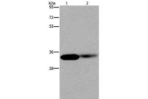 Western Blot analysis of Human kidney and Mouse lung tissue using LIMS1 Polyclonal Antibody at dilution of 1:200