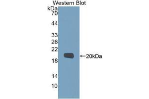 Western blot analysis of recombinant Human MMP9. (MMP 9 Antikörper  (AA 213-399))