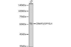 Western blot analysis of extracts of C6 cells, using CRMP3/DPYSL4 antibody (ABIN7266772) at 1:1000 dilution. (DPYSL4 Antikörper)