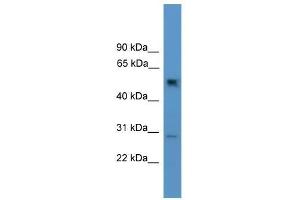 Western Blotting (WB) image for anti-Protein Phosphatase 2, Regulatory Subunit B, gamma (PPP2R2C) (N-Term) antibody (ABIN928998)