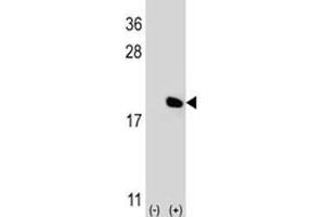 Western blot analysis of IL-17 antibody and 293 cell lysate (2 ug/lane) either nontransfected (Lane 1) or transiently transfected (2) with the IL17A gene. (Interleukin 17a Antikörper  (AA 61-87))
