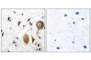 Immunohistochemistry (IHC) image for anti-Glutamate Receptor, Metabotropic 8 (GRM8) (C-Term) antibody (ABIN1848581) (GRM8 Antikörper  (C-Term))