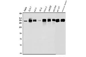 Western blot analysis of POLR2A using anti-POLR2A antibody (ABIN7599598).