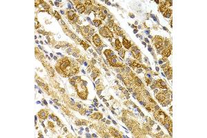 Immunohistochemistry of paraffin-embedded human stomach using BMP15 antibody at dilution of 1:100 (x40 lens). (BMP15 Antikörper)