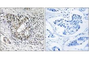 Immunohistochemistry (IHC) image for anti-Polyribonucleotide Nucleotidyltransferase 1 (PNPT1) (AA 570-619) antibody (ABIN6767063) (PNPT1 Antikörper  (AA 570-619))