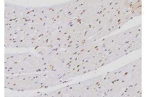 ABIN6257188 and ABIN6274272 at 1/100 staining Mouse heart tissue by IHC-P. (FXR2 Antikörper  (C-Term))
