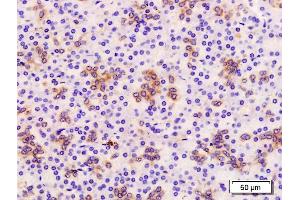 Formalin-fixed and paraffin embedded human pancreas labeled with Anti-TROP2/TACD2 Polyclonal Antibody, Unconjugated (ABIN715646) at 1:200 followed by conjugation to the secondary antibody and DAB staining (TACSTD2 Antikörper  (AA 221-322))