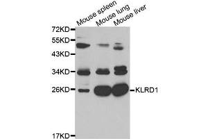 Western blot analysis of extracts of K562 cell lines, using KLRD1 antibody. (CD94 Antikörper  (AA 32-179))