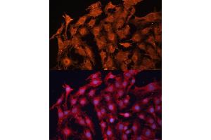 Immunofluorescence analysis of C6 cells using P Glycoprotein antibody (ABIN6129943, ABIN6136341, ABIN6136344 and ABIN6216612) at dilution of 1:100. (ABCB1 Antikörper  (AA 630-710))