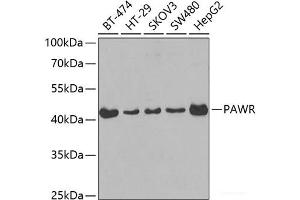 Western blot analysis of extracts of various cell lines using PAWR Polyclonal Antibody at dilution of 1:400. (PAWR Antikörper)