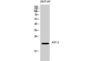 Western Blotting (WB) image for anti-Activating Transcription Factor 3 (ATF3) (C-Term) antibody (ABIN3183418) (ATF3 Antikörper  (C-Term))