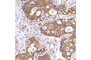 IHC analysis of Rab4/RAB4A using anti-Rab4/RAB4A antibody (ABIN7599733).