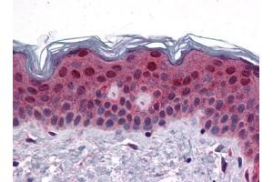 Human Skin: Formalin-Fixed, Paraffin-Embedded (FFPE) (FAM120B Antikörper  (C-Term))