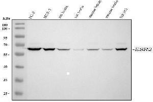 Western blot analysis of ESR2 using anti-ESR2 antibody (ABIN5518912).
