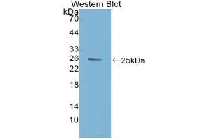 Western blot analysis of the recombinant protein. (BCL9 Antikörper  (AA 1119-1328))