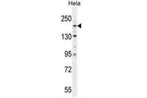 COL4A2 Antibody (N-term) western blot analysis in Hela cell line lysates (35µg/lane).