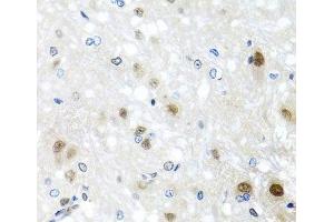 Immunohistochemistry of paraffin-embedded Rat brain using SAFB2 Polyclonal Antibody at dilution of 1:100 (40x lens). (SAFB2 Antikörper)