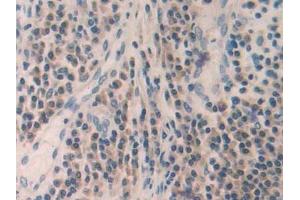 Immunohistochemistry (IHC) image for anti-Matrix Metallopeptidase 24 (Membrane-inserted) (MMP24) (AA 429-642) antibody (ABIN7441787)