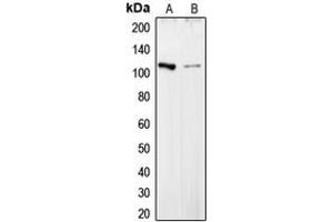 Western blot analysis of Collagen 6 alpha 2 expression in HepG2 (A), HT29 (B) whole cell lysates.