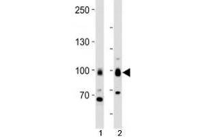 Western blot analysis of lysate from 1) MCF-7 cells and 2) human brain tissue using TLE1 antibody at 1:1000.
