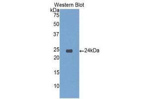 Western Blotting (WB) image for anti-Insulin-Like Growth Factor Binding Protein 6 (IGFBP6) (AA 51-226) antibody (ABIN3208922) (IGFBP6 Antikörper  (AA 51-226))
