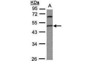 WB Image Sample(30 ug whole cell lysate) A:293T 10% SDS PAGE antibody diluted at 1:1000 (PIGK Antikörper)