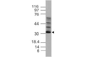 Image no. 1 for anti-Solute Carrier Family 25, Member 27 (SLC25A27) (AA 150-320) antibody (ABIN5027621) (SLC25A27 Antikörper  (AA 150-320))