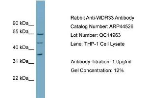 WB Suggested Anti-WDR33  Antibody Titration: 0. (WDR33 Antikörper  (N-Term))