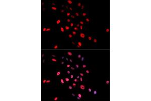 Immunofluorescence analysis of MCF-7 cells using Phospho-Jun-S63 antibody (ABIN5969905). (C-JUN Antikörper  (pSer63))