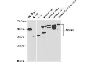 Western blot analysis of extracts of various cell lines, using NDRG2 antibody (ABIN6128325, ABIN6144451, ABIN6144452 and ABIN6220946) at 1:1000 dilution. (NDRG2 Antikörper  (AA 138-357))