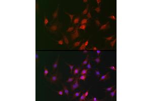 Immunohistochemistry of paraffin-embedded mouse lung using GAPDH Rabbit pAb (ABIN3020537, ABIN3020538 and ABIN3020539) at dilution of 1:100 (40x lens). (GAPDH Antikörper  (AA 1-335))