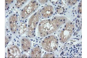 Image no. 1 for anti-Cancer/testis Antigen 1B (CTAG1B) antibody (ABIN1499890) (CTAG1B Antikörper)
