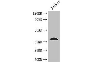 Western Blot Positive WB detected in: Jurkat whole cell lysate All lanes: MCL1 antibody at 3. (MCL-1 Antikörper  (AA 19-244))