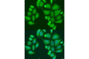 Immunofluorescence analysis of U2OS cells using CAPN2 antibody. (Calpain 2 Antikörper  (AA 350-680))