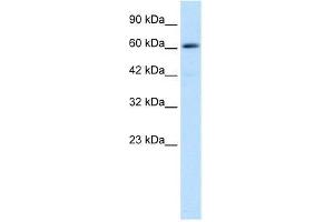 Human Jurkat; WB Suggested Anti-ZNF499 Antibody Titration: 0. (ZBTB45 Antikörper  (Middle Region))