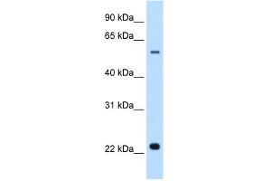 WB Suggested Anti-SLC17A5 Antibody Titration:  0. (Solute Carrier Family 17 (Acidic Sugar Transporter), Member 5 (SLC17A5) (N-Term) Antikörper)