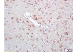 Formalin-fixed and paraffin embedded rat brain labeled with Rabbit Anti GAD67/GAD1 Polyclonal Antibody, Unconjugated (ABIN674679) at 1:200 followed by conjugation to the secondary antibody and DAB staining (GAD Antikörper  (AA 455-594))
