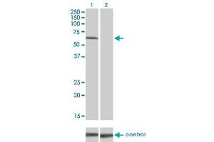 Western Blotting (WB) image for anti-Interleukin-1 Receptor-Associated Kinase 1 (IRAK1) (AA 530-693) antibody (ABIN561510)