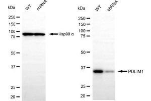 Western blotting analysis using PDLIM1 antibody (ABIN7799747). (PDLIM1 Antikörper)