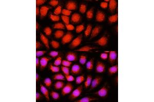 Immunofluorescence analysis of HeLa cells using ACADVL antibody  at dilution of 1:100 (40x lens).
