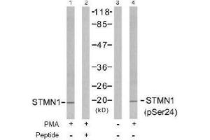 Image no. 2 for anti-Stathmin 1 (STMN1) (pSer24) antibody (ABIN196968) (Stathmin 1 Antikörper  (pSer24))