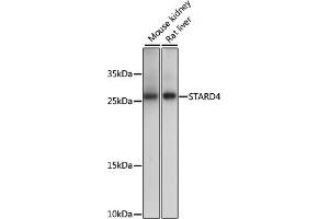 Western blot analysis of extracts of various cell lines, using ST antibody (ABIN7270584) at 1000 dilution. (STARD4 Antikörper  (AA 1-100))