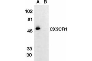 Image no. 1 for anti-Chemokine (C-X3-C Motif) Receptor 1 (CX3CR1) (AA 175-189) antibody (ABIN319015)