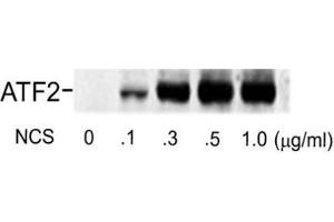 Western blot of human melanoma cells incubated with varying doses of the radiomimetic drug NCS showing specific immuno-labeling of the ~74k ATF2 protein phosphorylated at Ser490 and Ser498. (ATF2 Antikörper  (pSer490, pSer498))