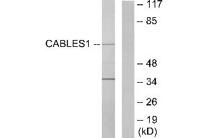 Western blot analysis of extracts from LOVO cells, using Ik3-1 antibody. (CABLES1 Antikörper)