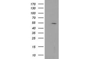 Western Blotting (WB) image for anti-Histone Deacetylase 1 (HDAC1) antibody (ABIN1498605)